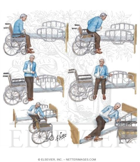 Transfer from Wheelchair to Bed After Stroke