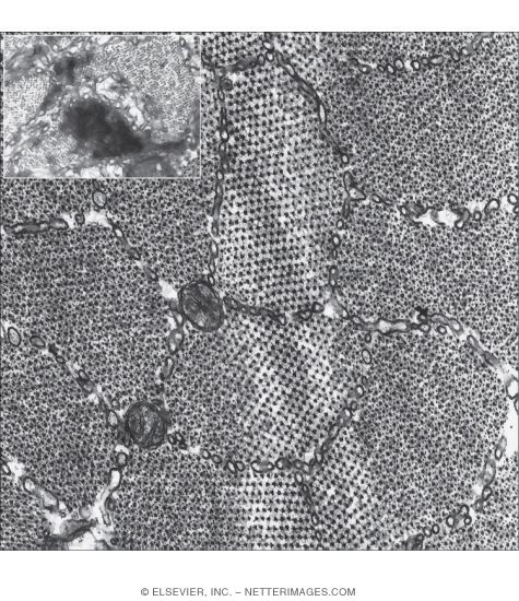 Electron Micrograph of Part of a Skeletal Muscle Fiber Showing