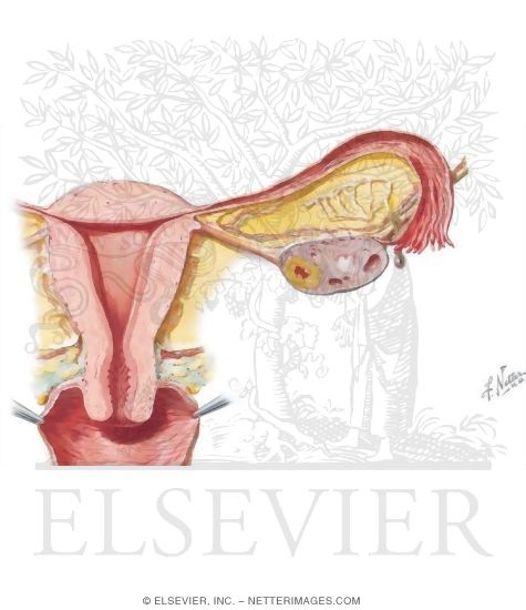 Uterus and Adnexa
