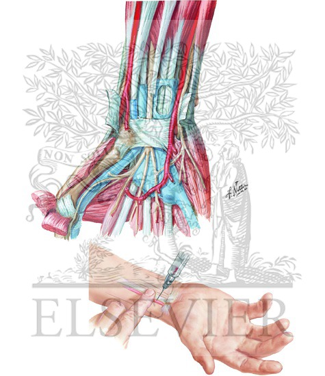 Arrangement of Tendons, Vessels, and Nerves at the Wrist