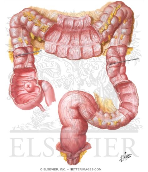 Large Intestine Structure
Mucosa and Musculature of Colon
Mucosa and Musculature of Large Intestine
Structure of Colon