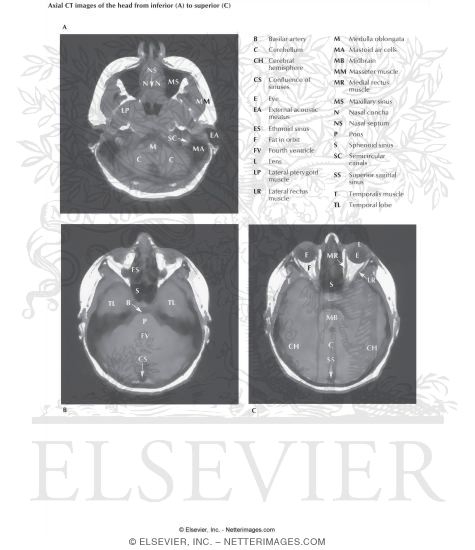 Head Scans: Axial CT Images