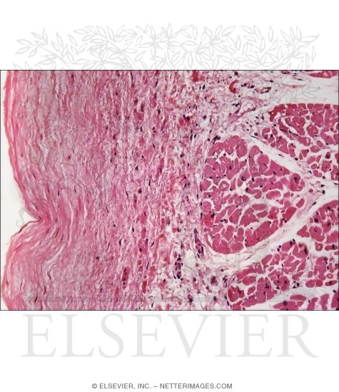 Light Micrograph of the Inner Part of the Atrial Wall