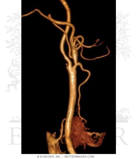 Carotid Artery System