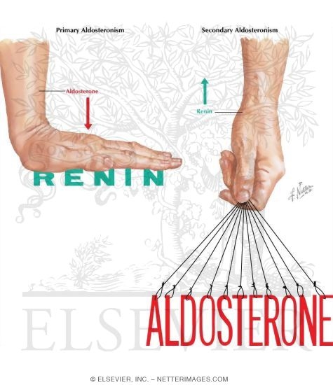 Secondary Aldosteronism