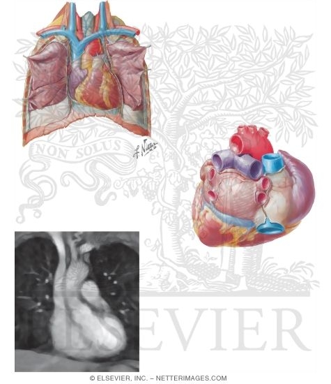 Anterior and Posterior Views of the Heart