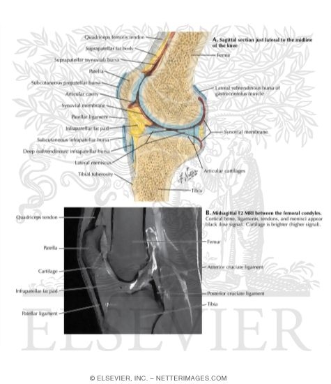 Sagittal View Mri Knee