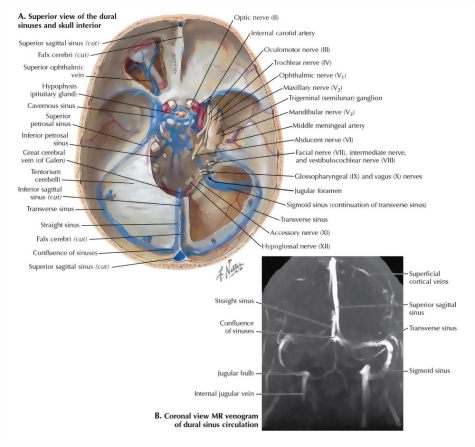 Dural Venous Sinuses