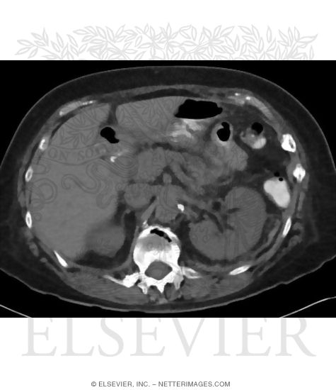 Large Intestine Imaging Studies