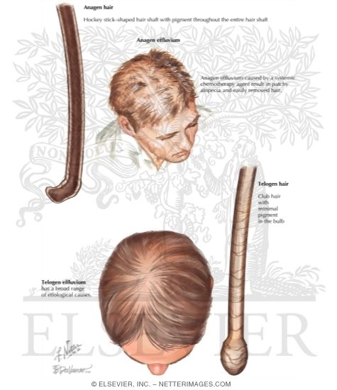 Diseases of the hair  Basicmedical Key