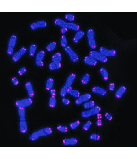 Metaphase chromosomes with telomeres
