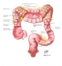 CrossFit  The Gastrointestinal System: The Large Intestine